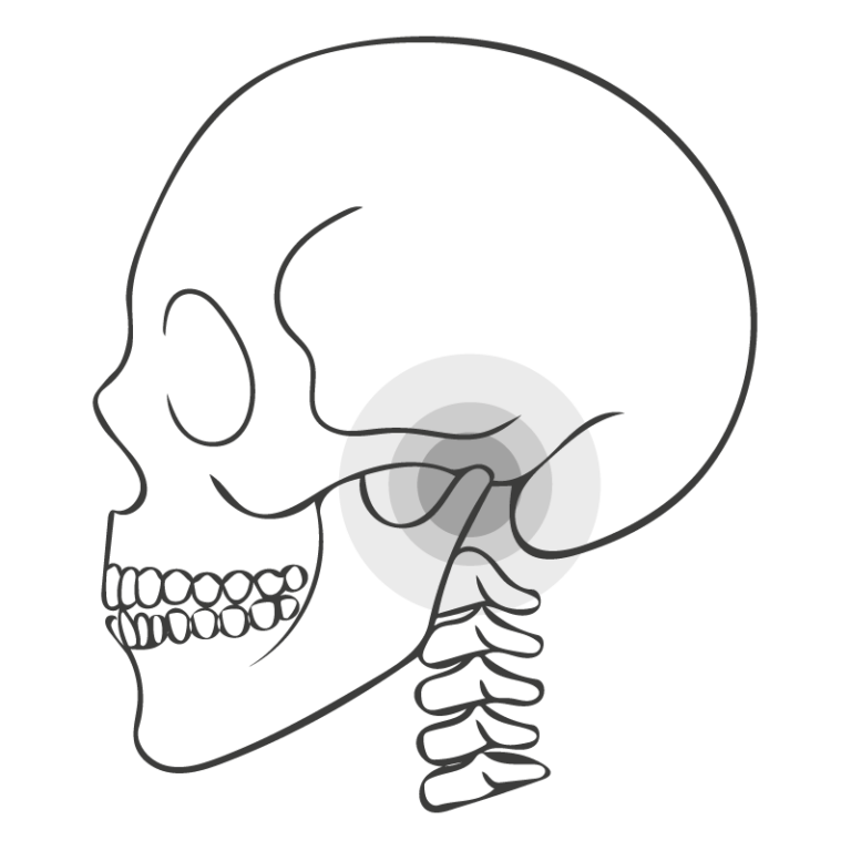 Strichgrafik eines menschlichen Schädels zur Therapie von Kiefergelenksbeschwerden (CMD), illustriert von Michelle Amthor für SpiraDent in Speyer.