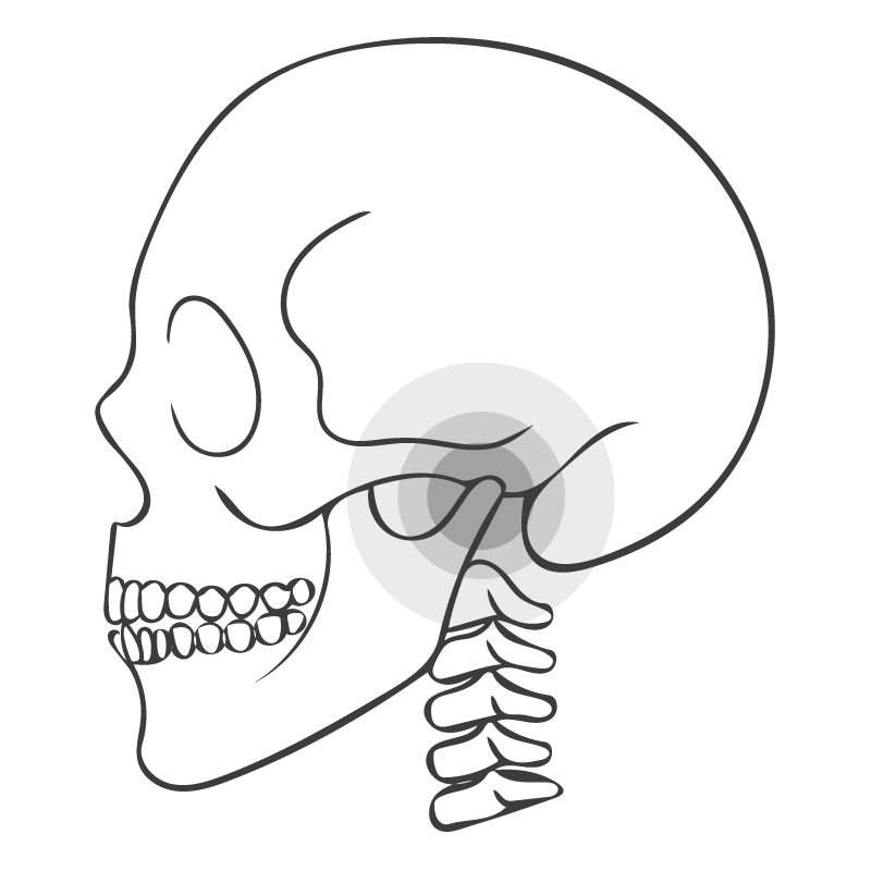 Strichgrafik eines menschlichen Schädels zur Therapie von Kiefergelenksbeschwerden (CMD), illustriert von Michelle Amthor für SpiraDent in Speyer.