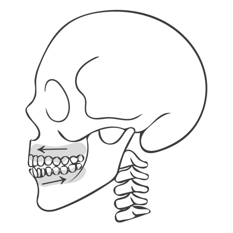 Strichgrafik eines menschlichen Schädels mit hervorgehobenen Kieferbewegungen, dargestellt für eine kieferorthopädisch-kieferchirurgische Behandlung, illustriert von Michelle Amthor für SpiraDent in Speyer.