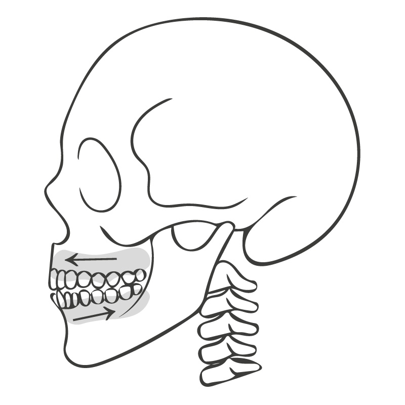 Strichgrafik eines menschlichen Schädels mit hervorgehobenen Kieferbewegungen, dargestellt für eine kieferorthopädisch-kieferchirurgische Behandlung, illustriert von Michelle Amthor für SpiraDent in Speyer.