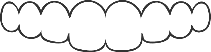 Strichgrafik eines Zahnbogens mit einem durchsichtigen Aligner, zur Darstellung moderner kieferorthopädischer Behandlungen.